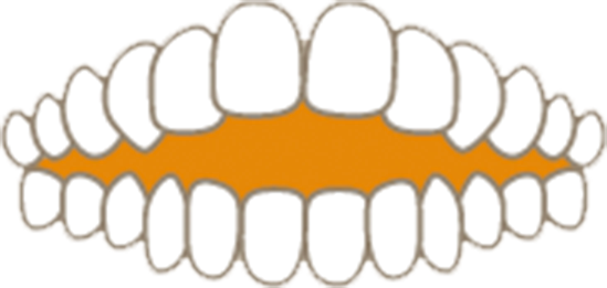 口が閉じない（開咬・オープンバイト）