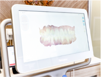 当院では診断用のデジタル機器を導入し、現状を精密に撮影。事前シミュレーターで理想形を事前に創造します