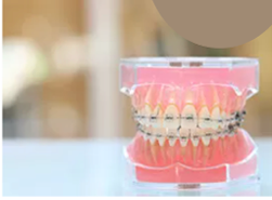 出っ歯・デコボコなどあらゆる症例に対応